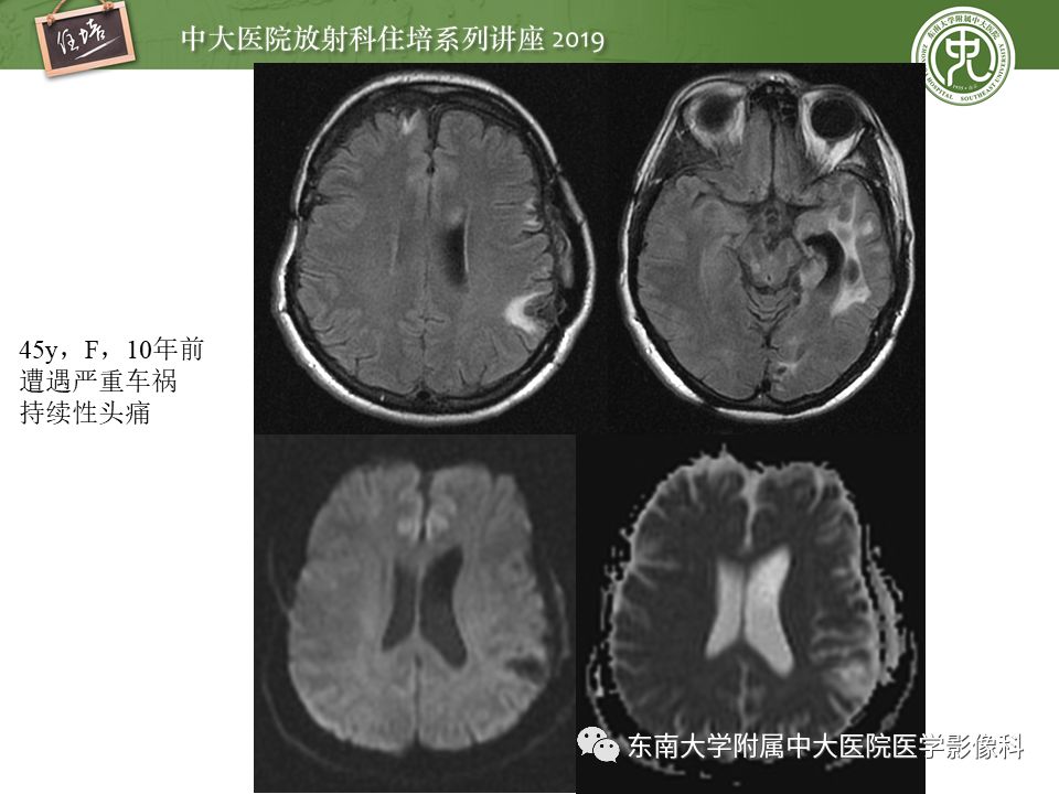 【PPT】成人颅脑损伤影像评估基本原则