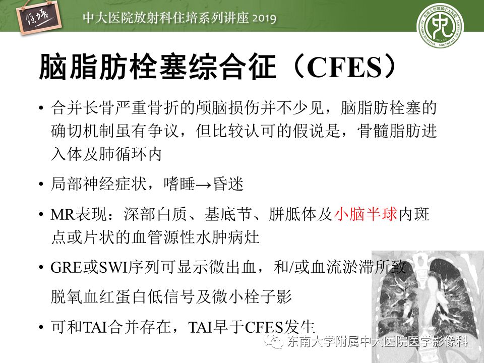 【PPT】成人颅脑损伤影像评估基本原则