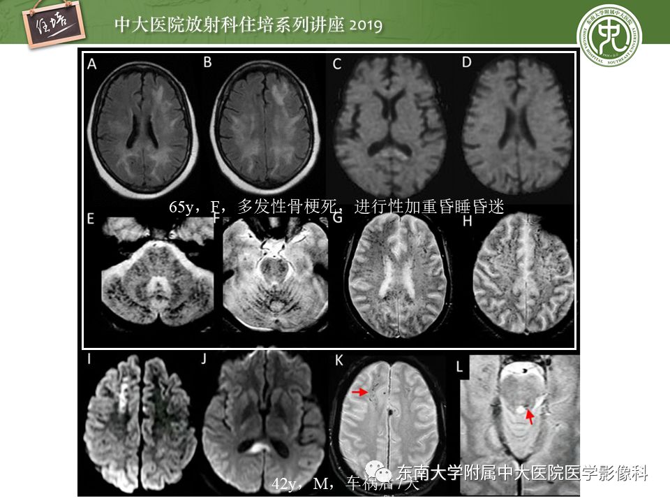 【PPT】成人颅脑损伤影像评估基本原则