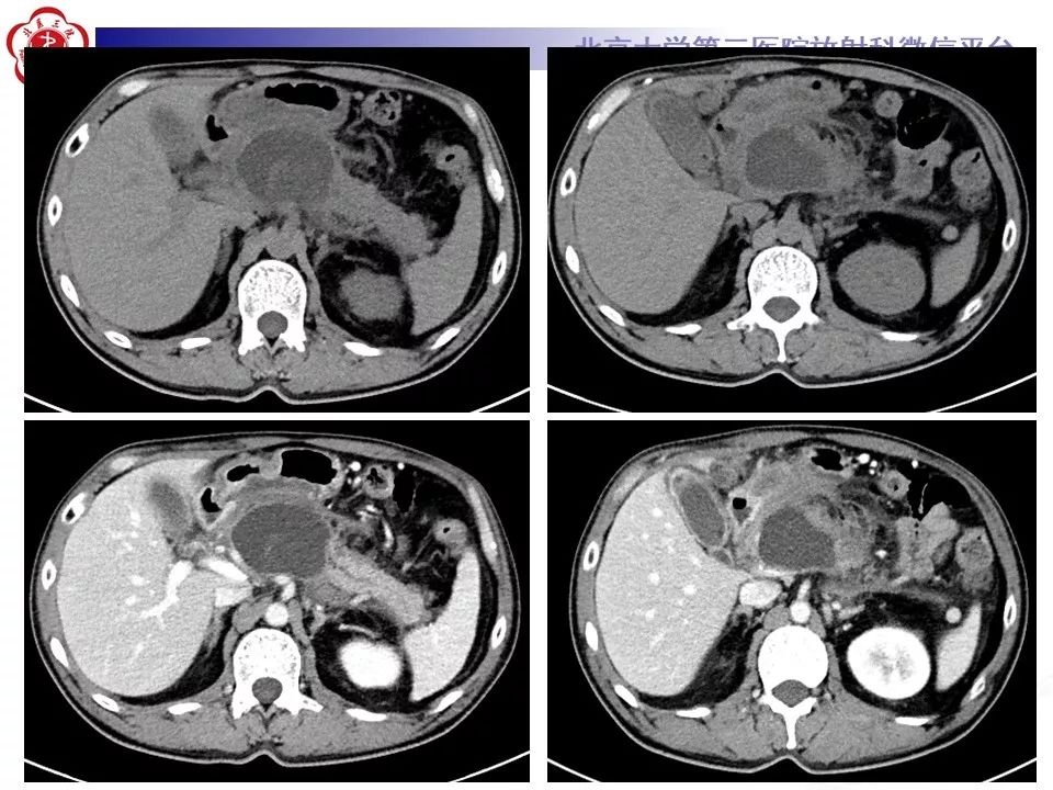 【病例】