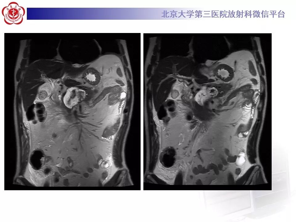 【病例】