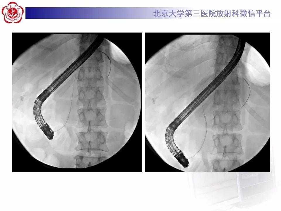 【病例】