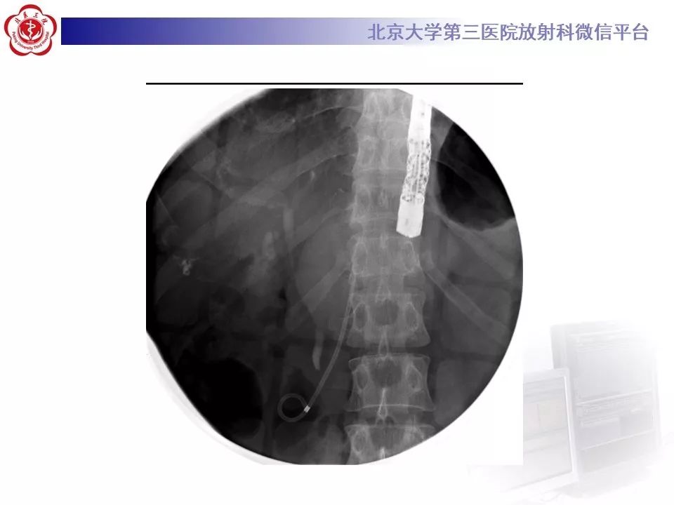 【病例】