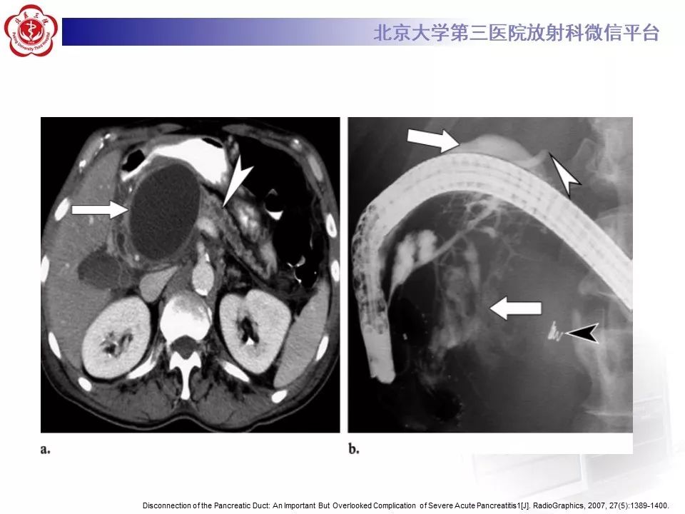 【病例】