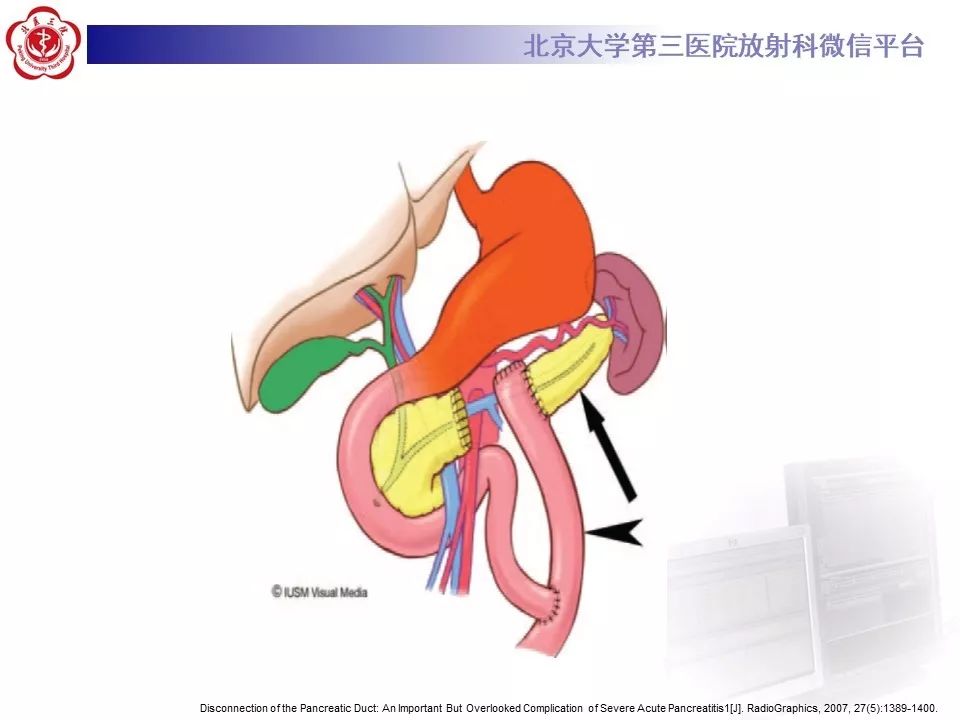 【病例】