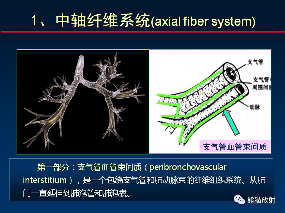 【PPT】正确判读肺间质改变的基本CT表现