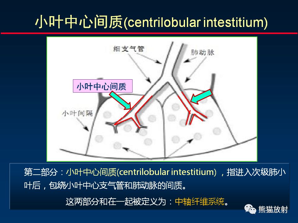 【PPT】正确判读肺间质改变的基本CT表现