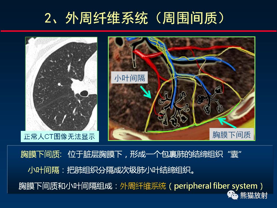 【PPT】正确判读肺间质改变的基本CT表现