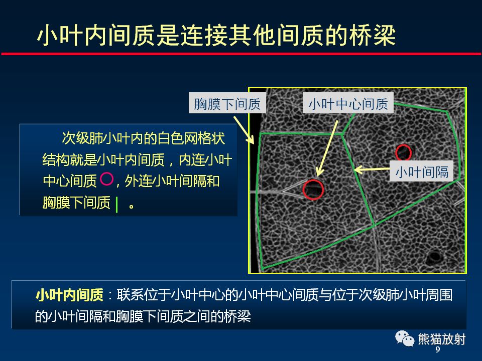 【PPT】正确判读肺间质改变的基本CT表现