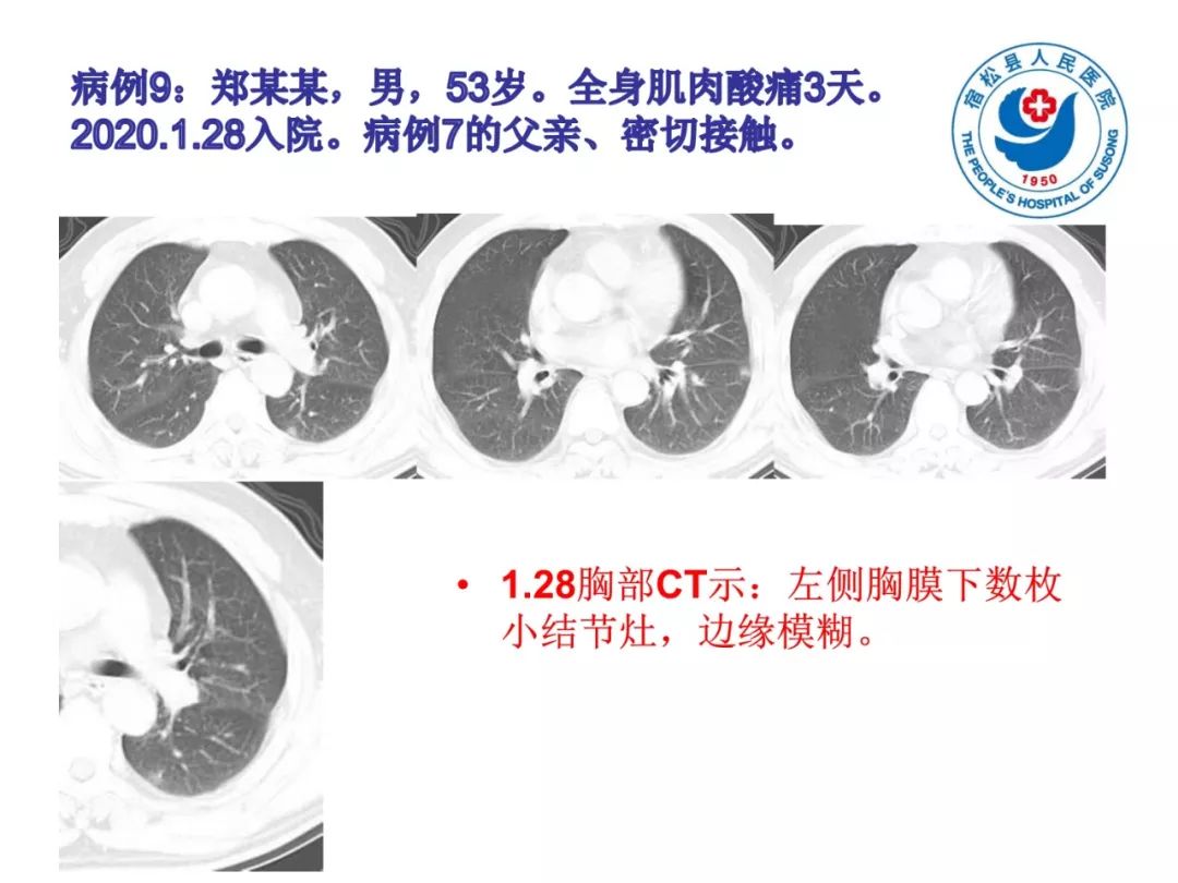 【PPT】(来自一个县医院的12例)我院新型冠状病毒肺炎特点