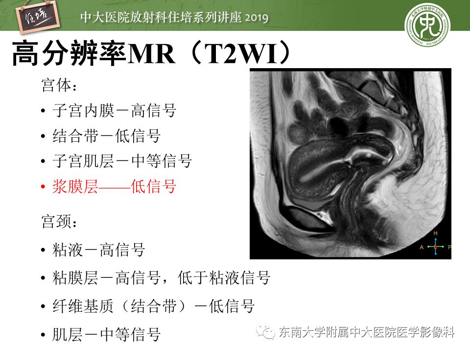 【PPT】子宫影像解剖及相关MR信号分析