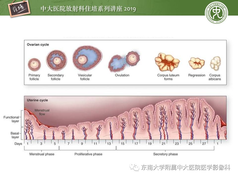 【PPT】子宫影像解剖及相关MR信号分析