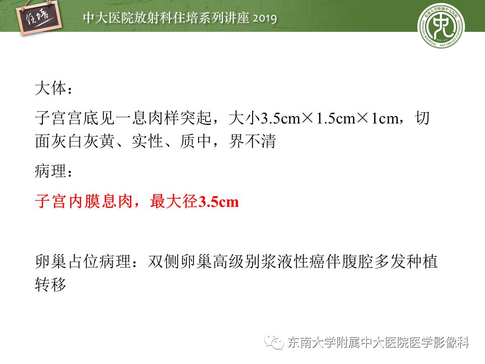 【PPT】子宫影像解剖及相关MR信号分析