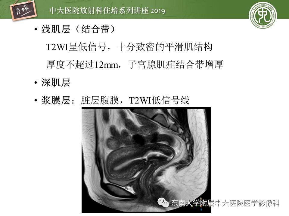 【PPT】子宫影像解剖及相关MR信号分析