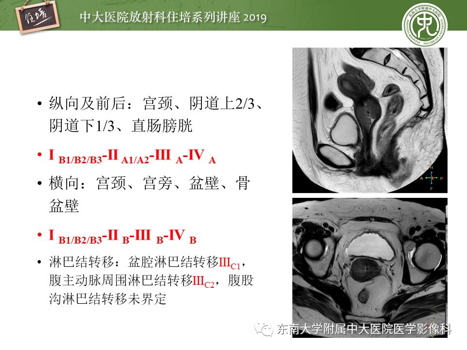 【PPT】子宫影像解剖及相关MR信号分析