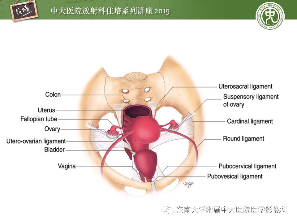 【PPT】子宫影像解剖及相关MR信号分析