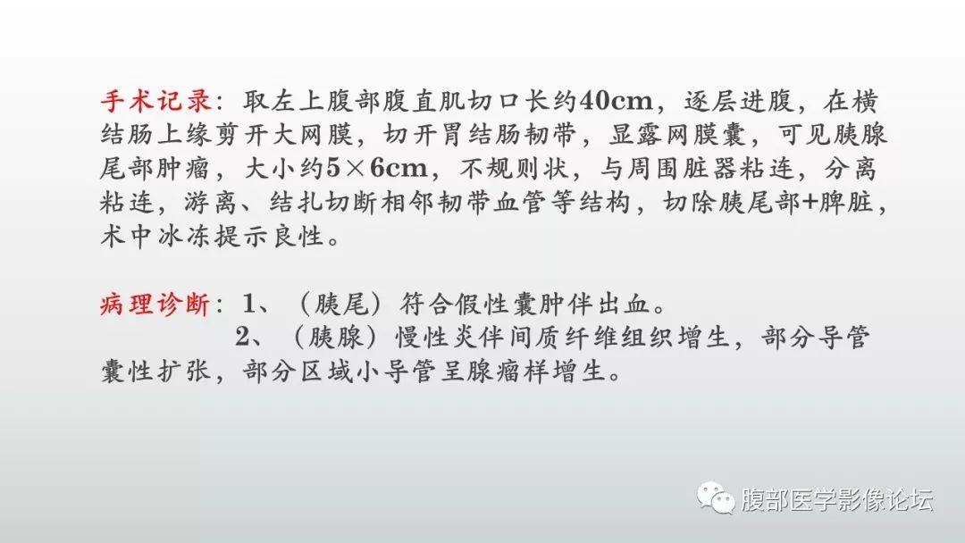 【病例】胰腺尾部假性囊肿伴出血1例CT及MR