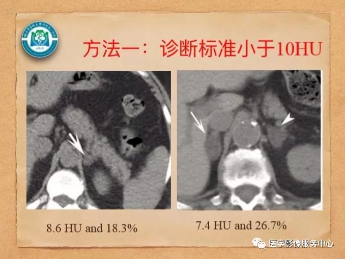 【PPT】肾上腺结节的CT和MRI诊断—肾上腺结节诊断三板斧