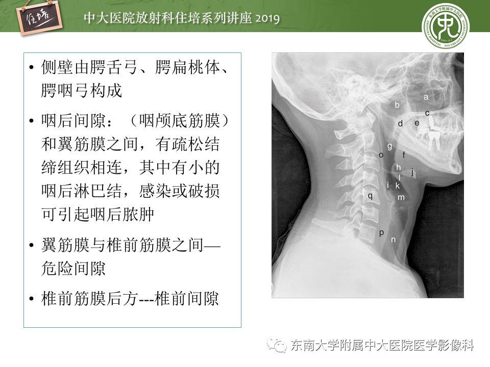 【PPT】口咽部异物及感染性病变的影像诊断
