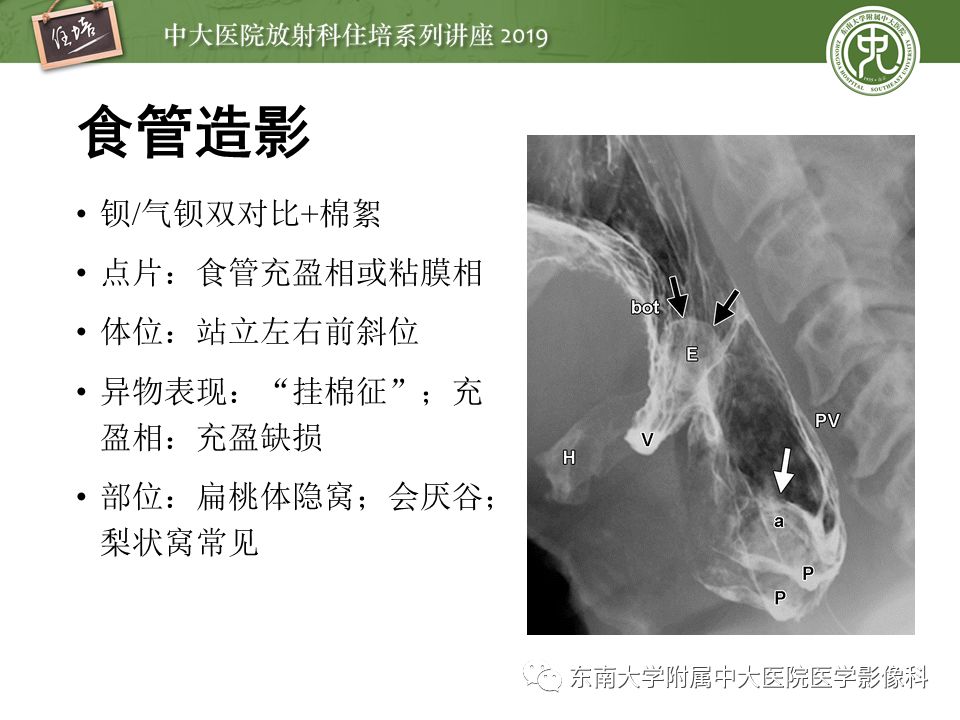 【PPT】口咽部异物及感染性病变的影像诊断
