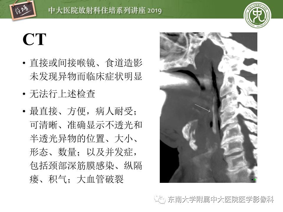 【PPT】口咽部异物及感染性病变的影像诊断