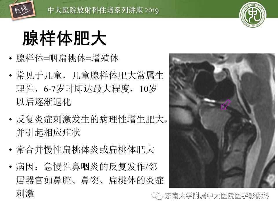 【PPT】口咽部异物及感染性病变的影像诊断