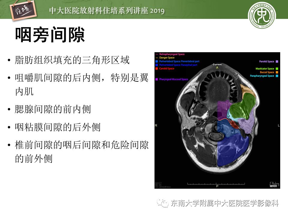 【PPT】口咽部异物及感染性病变的影像诊断