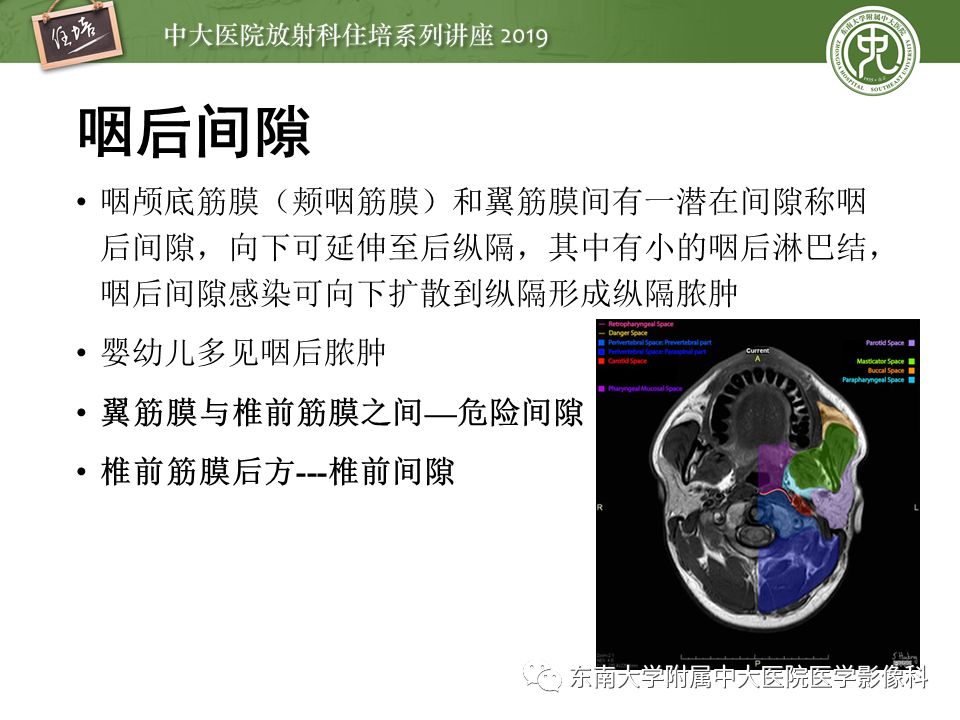 【PPT】口咽部异物及感染性病变的影像诊断