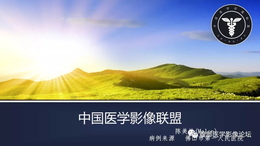 【病例】肾上腺皮质腺瘤伴出血1例CT影像