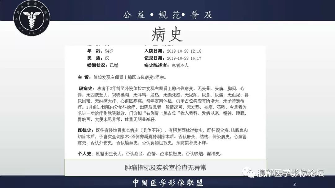 【病例】肾上腺皮质腺瘤伴出血1例CT影像