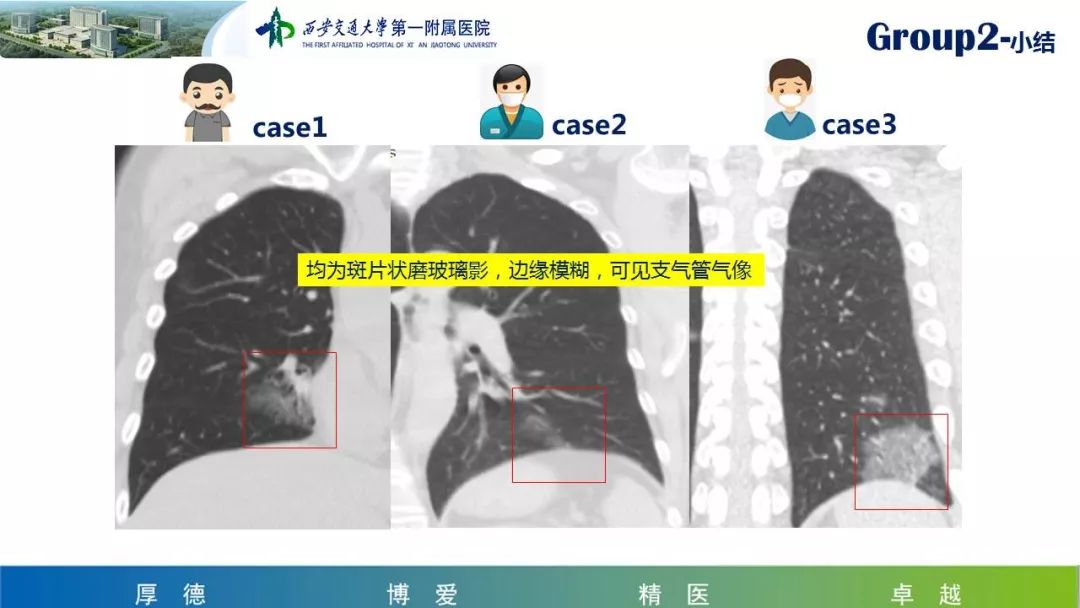 【PPT】19-nCoV新型冠状病毒肺炎患者影像学病例分享第二期