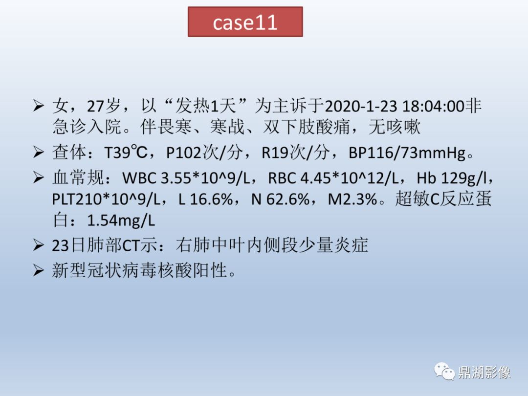 【PPT】新型冠状病毒感染的肺炎影像汇集