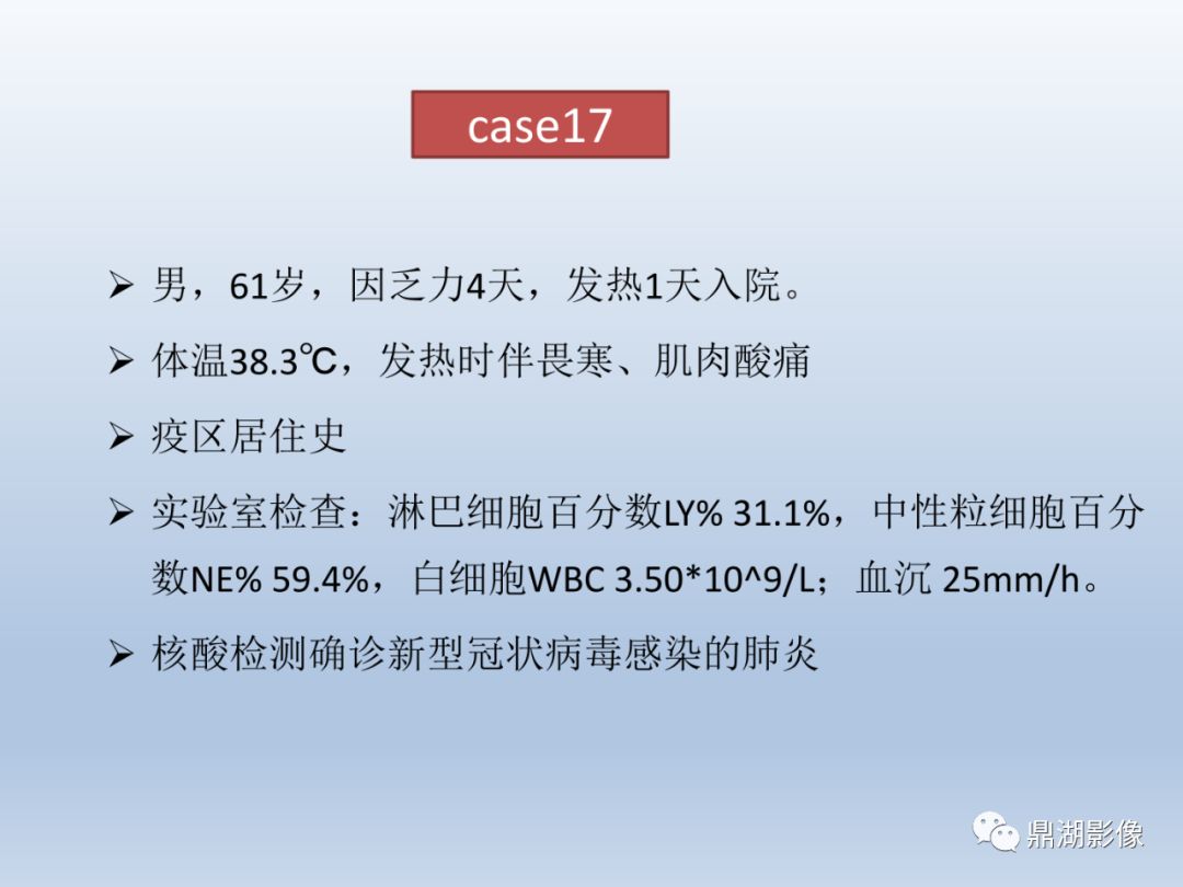 【PPT】新型冠状病毒感染的肺炎影像汇集