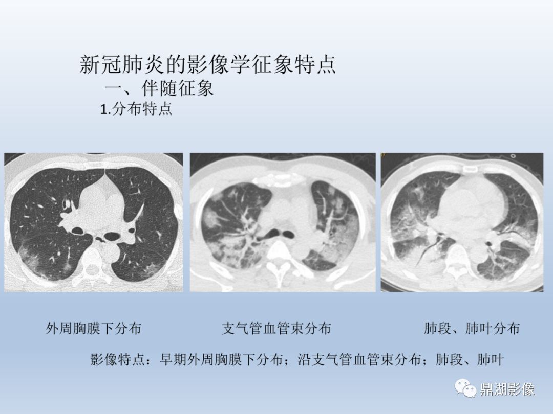 【PPT】新型冠状病毒感染的肺炎影像汇集