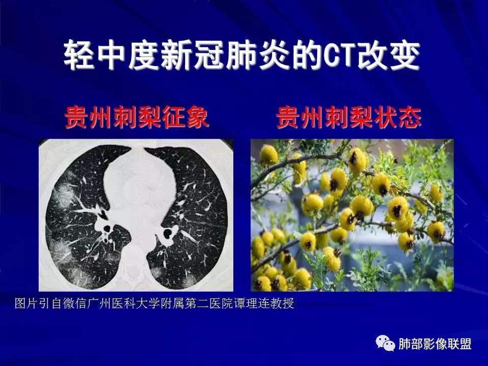 【PPT】新型冠状病毒肺炎CT征象识别及快速诊断