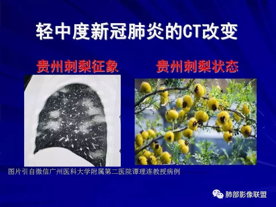 【PPT】新型冠状病毒肺炎CT征象识别及快速诊断
