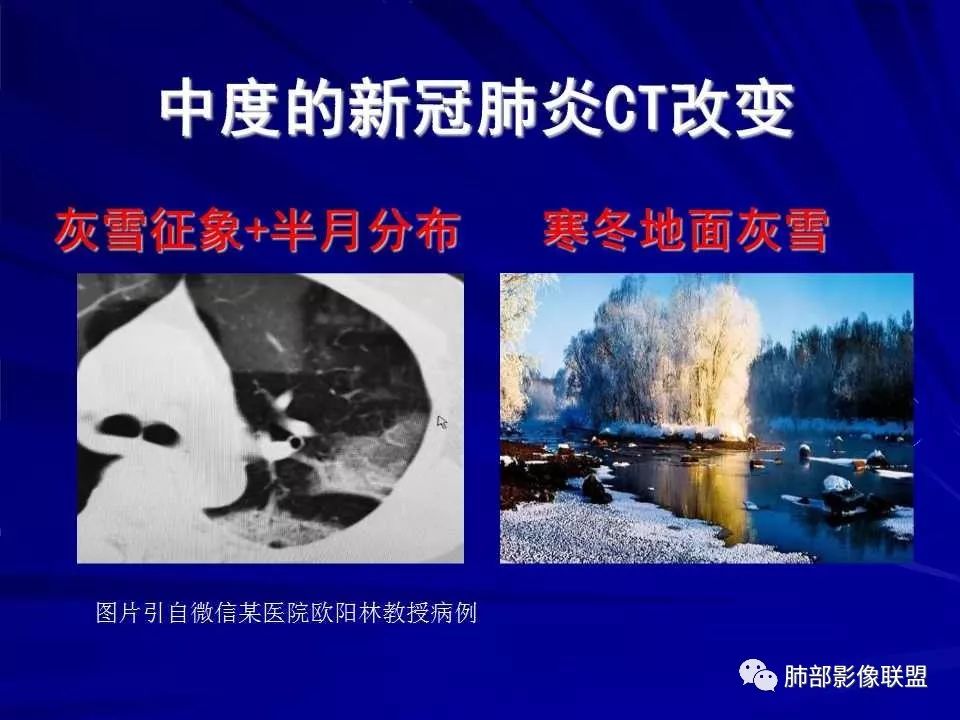 【PPT】新型冠状病毒肺炎CT征象识别及快速诊断