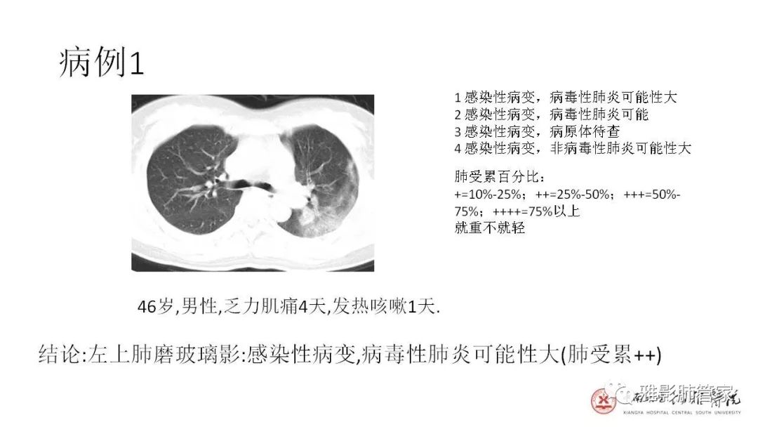 【PPT】快速掌握2019-nCoV新型冠状病毒肺炎CT影像学表现及报告规范