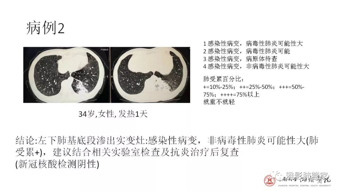 【PPT】快速掌握2019-nCoV新型冠状病毒肺炎CT影像学表现及报告规范