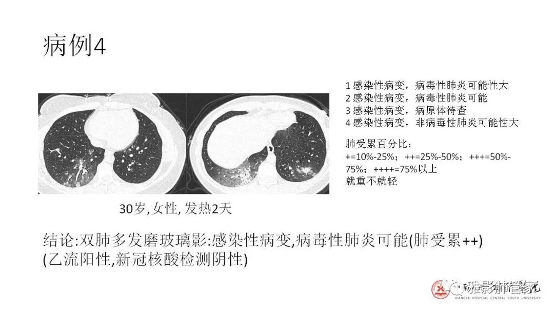 【PPT】快速掌握2019-nCoV新型冠状病毒肺炎CT影像学表现及报告规范