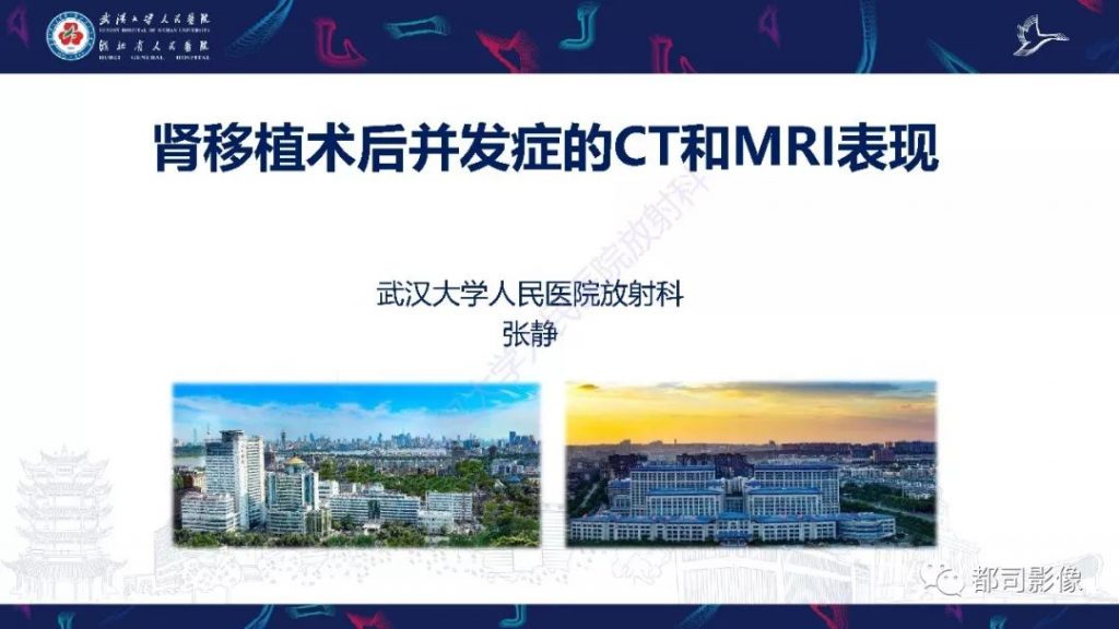 【PPT】肾移植术后并发症的CT和MRI表现