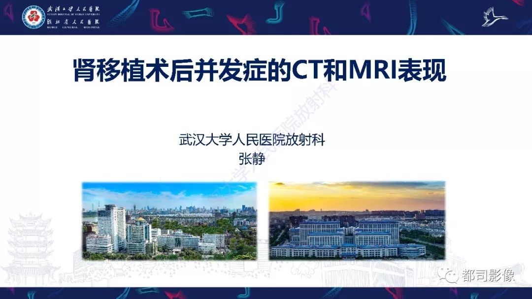 【PPT】肾移植术后并发症的CT和MRI表现