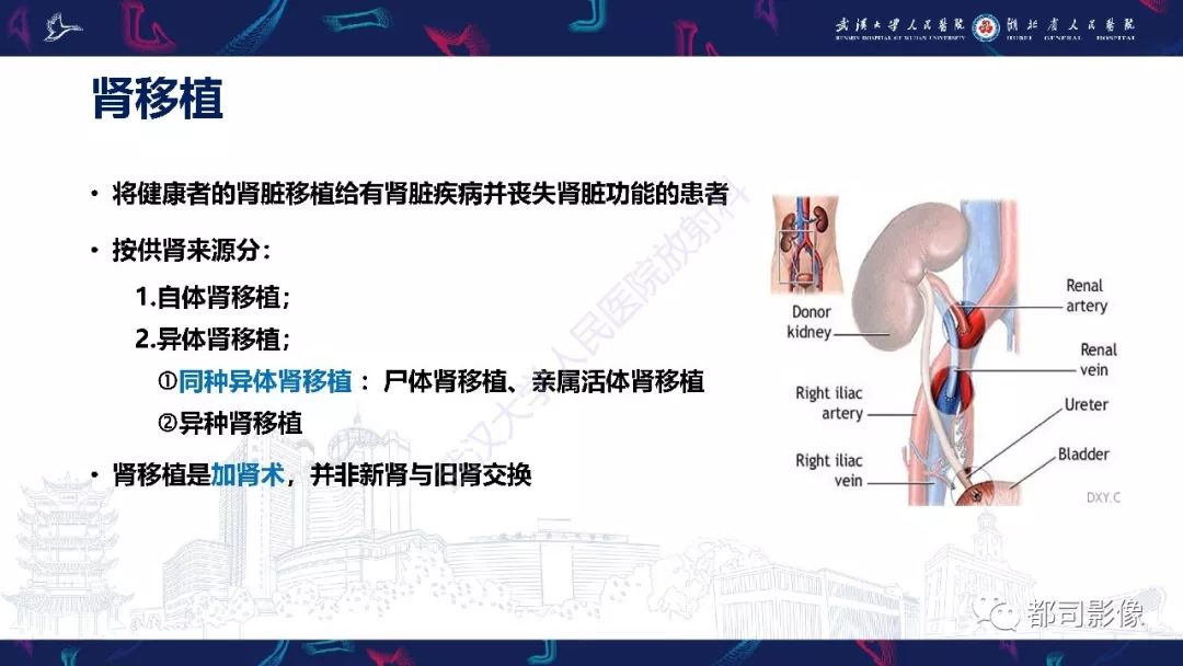 【PPT】肾移植术后并发症的CT和MRI表现