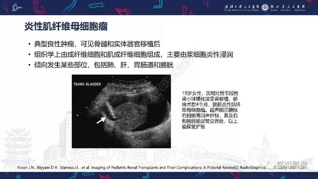 【PPT】肾移植术后并发症的CT和MRI表现