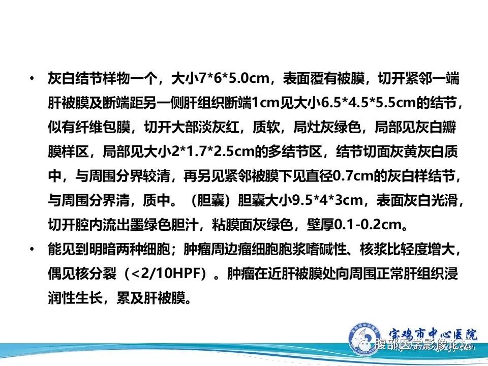 【病例】成人型肝母细胞瘤1例CT及MR