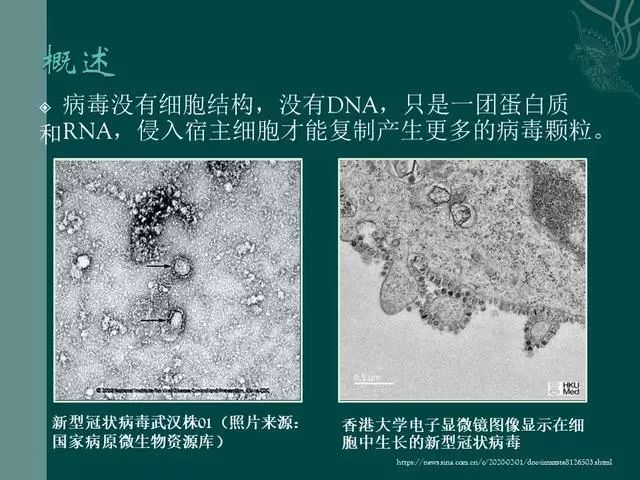 【PPT】病毒性肺炎概念与CT表现—新型冠状病毒肺炎