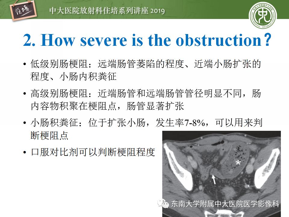 【PPT】小肠梗阻的影像分析及诊断