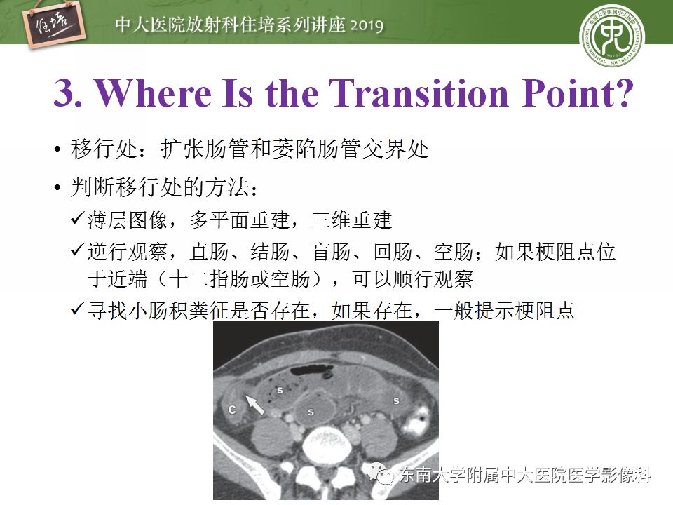 【PPT】小肠梗阻的影像分析及诊断