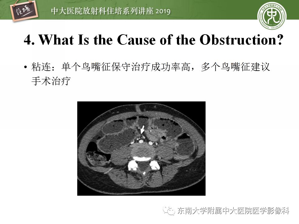 【PPT】小肠梗阻的影像分析及诊断