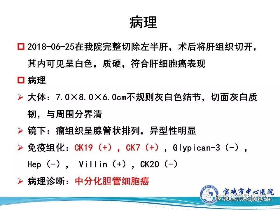 【病例】肝内胆管细胞癌1例CT及MR影像表现